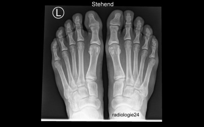 R�ntgenfall des Monats